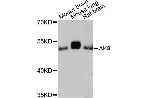 Western blot analysis of extracts of various cell lines, using AK8 antibody (ABIN6292827) at 1:3000 dilution.