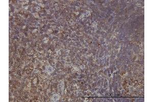 Immunoperoxidase of monoclonal antibody to RPL9 on formalin-fixed paraffin-embedded human tonsil tissue.