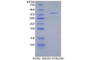 SDS-PAGE analysis of Human LFA1A Protein. (ITGAL Protéine)