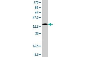 Western Blot detection against Immunogen (38.