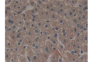 Detection of NCF4 in Mouse Liver Tissue using Polyclonal Antibody to Neutrophil Cytosolic Factor 4 (NCF4)