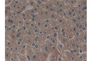 Detection of NCF4 in Mouse Liver Tissue using Polyclonal Antibody to Neutrophil Cytosolic Factor 4 (NCF4) (NCF4 anticorps  (AA 111-339))