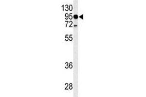 Western blot analysis of TLR4 antibody and HL-60 lysate. (TLR4 anticorps  (AA 669-698))