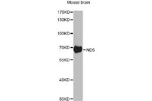 Western blot analysis of extracts of mouse brain, using ND5 antibody.