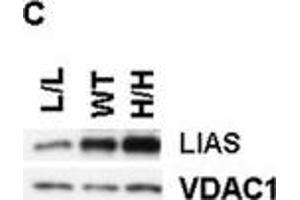 Characterizations of the new mouse model. (LIAS anticorps)