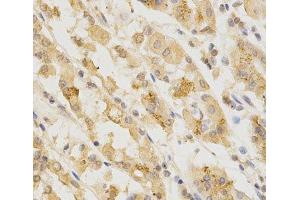 Immunohistochemistry of paraffin-embedded Human stomach using GGA2 Polyclonal Antibody at dilution of 1:200 (40x lens). (GGA2 anticorps)