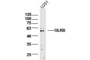 U251 cell lysates probed with GLRB Polyclonal Antibody, Unconjugated (bs-20450R) at 1:300 overnight at 4˚C. (GLRB anticorps  (AA 51-150))