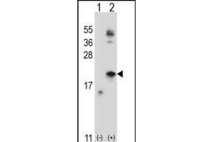 Western blot analysis of IL21 (arrow) using rabbit polyclonal IL21 Antibody (C-term) (ABIN657761 and ABIN2846740). (IL-21 anticorps  (C-Term))