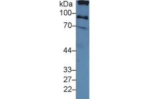 Western blot analysis of Human Serum, using Human ITIH2 Antibody (3 µg/ml) and HRP-conjugated Goat Anti-Rabbit antibody ( (ITIH2 anticorps  (AA 452-702))