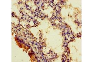 Immunohistochemistry of paraffin-embedded human lung tissue using ABIN7167709 at dilution of 1:100 (RGMA anticorps  (AA 153-408))