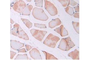 IHC-P analysis of Rat Skeletal Muscle Tissue, with DAB staining.