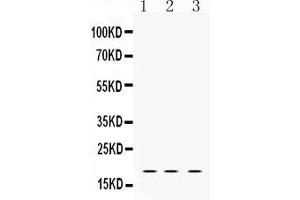 Western blot analysis of LMO1 expression in rat brain extract ( Lane 1), NIH3T3 whole cell lysates ( Lane 2) and HELA whole cell lysates ( Lane 3). (LMO1 anticorps  (C-Term))