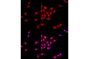 Immunofluorescence analysis of PC-12 cells using DNA Ligase III/LIG3 Rabbit pAb (ABIN6130288, ABIN6143207, ABIN6143208 and ABIN6217532) at dilution of 1:50 (40x lens).