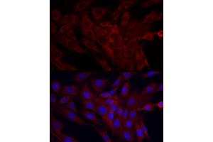 Immunofluorescence analysis of NIH/3T3 cells using SRP72 Rabbit pAb (ABIN6134166, ABIN6148452, ABIN7101299 and ABIN7101300) at dilution of 1:100 (40x lens).