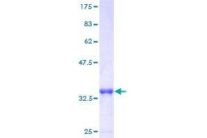 Image no. 1 for LSM6 Homolog, U6 Small Nuclear RNA Associated (LSM6) (AA 1-80) protein (GST tag) (ABIN1309851)