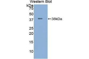 Western blot analysis of the recombinant protein. (UCHL5 anticorps  (C-Term))