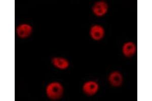 ABIN6276536 staining HepG2? (CTCF anticorps  (C-Term))
