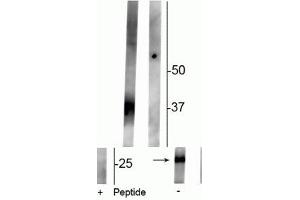 Western blot of rat kidney lysate showing specific immunolabeling of the ~29 kDa and 37 kDa glycosylated form of the AQP2 protein phosphorylated at Ser261 in the first lane (-). (AQP2 anticorps  (pSer261))