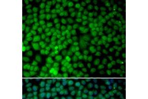 Immunofluorescence analysis of MCF-7 cells using RBX1 Polyclonal Antibody (RBX1 anticorps)