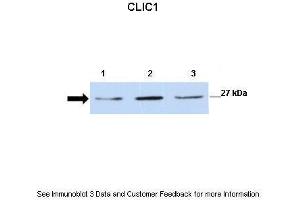 Lanes:   Lane 1: 30ug mouse renal epithelial lysate Lane 2: 30ug mouse renal epithelial lysate Lane 3: 30ug mouse renal epithelial lysate  Primary Antibody Dilution:   1:500  Secondary Antibody:   Anti-rabbit-HRP  Secondary Antibody Dilution:   1:2500  Gene Name:   CLIC1  Submitted by:   Dr.