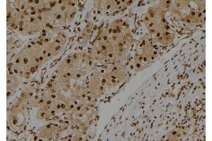 ABIN6275419 at 1/100 staining Human kidney tissue by IHC-P.