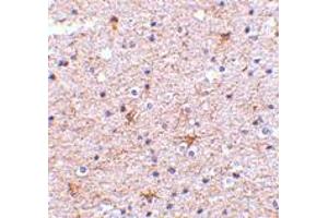 Immunohistochemistry of TMED10 in human brain tissue with TMED10 polyclonal antibody  at 2. (TMED10 anticorps  (C-Term))