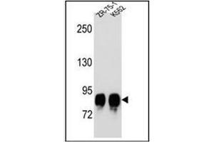 Western blot analysis of POMT1 Antibody (C-term) in ZR-75-1,K562 cell line lysates (35ug/lane). (POMT1 anticorps  (C-Term))