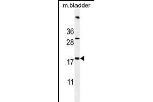 ACN9 Antibody (N-term) (ABIN655002 and ABIN2844636) western blot analysis in mouse bladder tissue lysates (35 μg/lane).