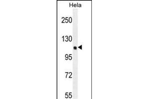 KI Antibody (C-term) (ABIN655488 and ABIN2845010) western blot analysis in Hela cell line lysates (35 μg/lane). (KIAA0999 (AA 1233-1263), (C-Term) anticorps)