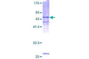 Image no. 1 for Ankyrin Repeat and SOCS Box-Containing 1 (ASB1) (AA 1-335) protein (GST tag) (ABIN1345793)
