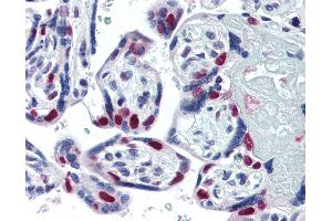 Anti-PARP antibody IHC of human placenta. (PARP1 anticorps)