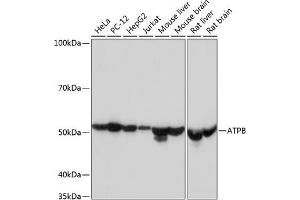 Western blot analysis of extracts of various cell lines, using ATPB Rabbit mAb (ABIN7265722) at 1:1000 dilution.