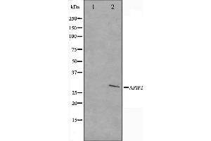 Western blot analysis on COLO205 cell lysate using APAF1 Antibody.