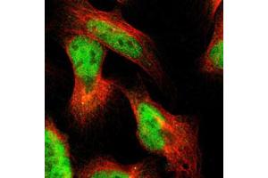 Immunofluorescent staining of U-2 OS with PRKAG2 polyclonal antibody  (Green) shows positivity in nucleus but excluded from the nucleoli. (PRKAG2 anticorps)