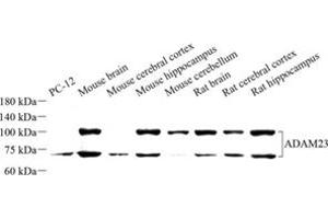 Western blot analysis of ADAM23 (ABIN7072942) at dilution of 1: 500 (Adam23 anticorps)