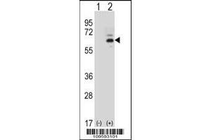 Western blot analysis of FASTK using rabbit polyclonal FASTK Antibody using 293 cell lysates (2 ug/lane) either nontransfected (Lane 1) or transiently transfected (Lane 2) with the FASTK gene. (FASTK anticorps  (C-Term))