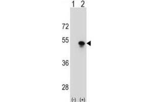 Western Blotting (WB) image for anti-Small Nuclear RNA Activating Complex, Polypeptide 1, 43kDa (SNAPC1) antibody (ABIN2998745)