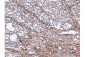 Detection of GFAP in Rat Spinal cord Tissue using Polyclonal Antibody to Glial Fibrillary Acidic Protein (GFAP)