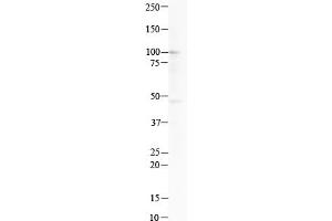 Host:  Rabbit  Target Name:  CTH  Sample Type:  Human K562 cell lysate  Antibody Dilution:  1.