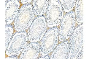 ABIN6260703 and ABIN6268787 at 1/100 staining Rat testis tissue by IHC-P. (N-Cadherin anticorps  (C-Term))