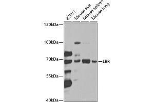 Western blot analysis of extracts of various cell lines, using LBR antibody (ABIN6128194, ABIN6143105, ABIN6143106 and ABIN6221130) at 1:1000 dilution. (Lamin B Receptor anticorps  (AA 1-211))