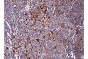 Image no. 2 for anti-Isocitrate Dehydrogenase 1 (NADP+), Soluble (IDH1) antibody (ABIN1502107)