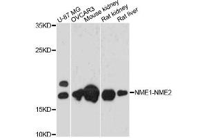 Western blot analysis of extracts of various cell lines, using NME1-NME2 antibody. (NME1-NME2 anticorps)