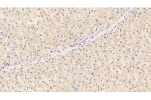 Detection of RBP4 in Human Liver Tissue using Monoclonal Antibody to Retinol Binding Protein 4 (RBP4)