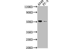 Western Blot Positive WB detected in: A549 whole cell lysate, PC-3 whole cell lysate All lanes: TNFRSF1A antibody at 1:2000 Secondary Goat polyclonal to rabbit IgG at 1/50000 dilution Predicted band size: 51, 39, 26, 25 kDa Observed band size: 51 kDa
