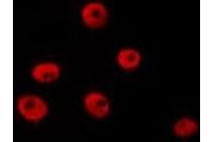 ABIN6277211 staining HepG2 by IF/ICC. (Histone 3 anticorps  (H3R8me2))