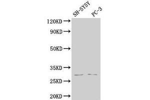 Western Blot Positive WB detected in: SH-SY5Y whole cell lysate, PC-3 whole cell lysate All lanes: APH1B antibody at 1:2000 Secondary Goat polyclonal to rabbit IgG at 1/50000 dilution Predicted band size: 29, 25 kDa Observed band size: 29 kDa (APH1B anticorps  (AA 93-110))