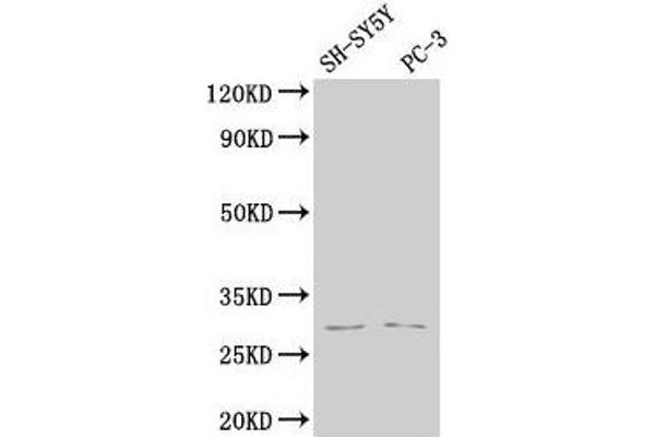 APH1B antibody  (AA 93-110)