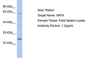 Host: Rabbit Target Name: NAT9 Sample Tissue: Human Fetal Spleen Antibody Dilution: 1ug/ml (NAT9 anticorps  (C-Term))