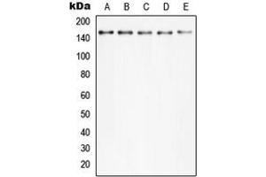 Western blot analysis of PLC gamma 2 (pY753) expression in Hela TNFa-treated (A), MCF7 (B), Raw264. (Phospholipase C gamma 2 anticorps  (pTyr753))